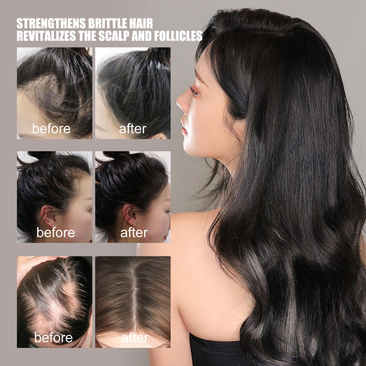 Óleo Essencial para Reparação e Cuidados com o Crescimento do Cabelo