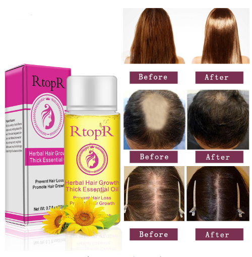Tratamento Líquido em Óleo Essencial para Crescimento Rápido e Potente do Cabelo e Prevenção de Queda, 20 ml