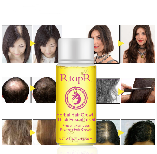Tratamento Líquido em Óleo Essencial para Crescimento Rápido e Potente do Cabelo e Prevenção de Queda, 20 ml